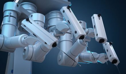 Braços robóticos do sistema cirúrgico utilizados em procedimentos minimamente invasivos.