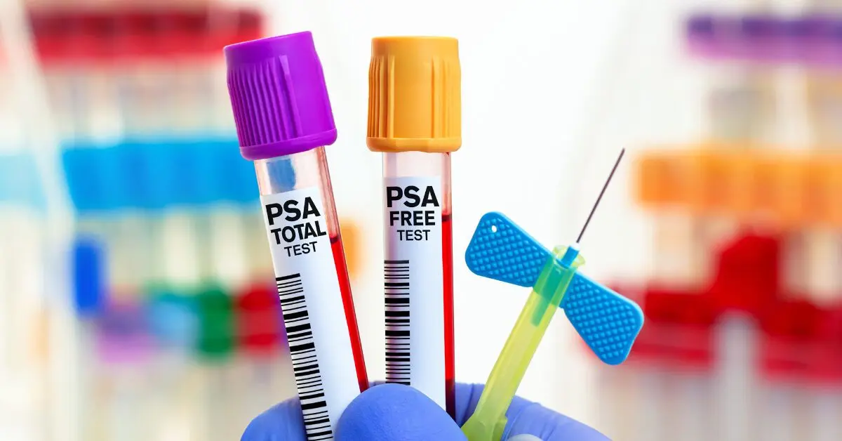 PSA total e livre