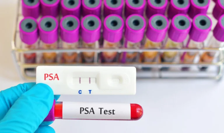 PSA total e livre
